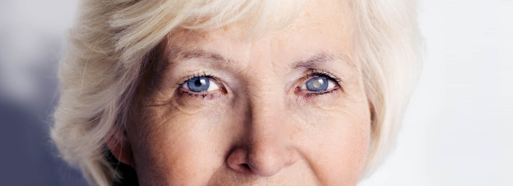 Cataract Surgery in Chandler