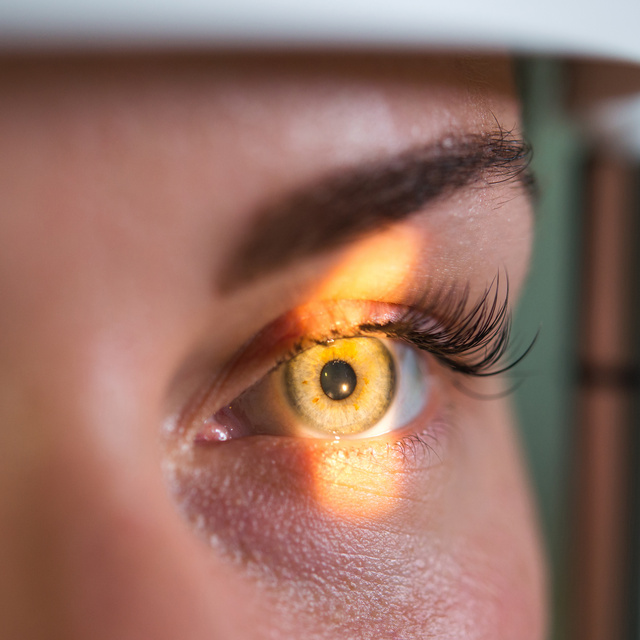 Vision Therapy in Chandler